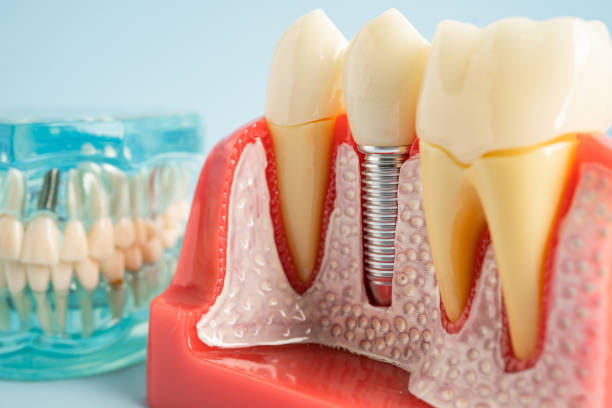 Best Cosmetic Dentistry  in Long Beach, CA